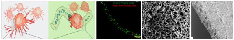 Bioengineered stem cells to restrict metastatic potential of cancer cells and micro- and nanofabricated scaffolds for 3D Culture.