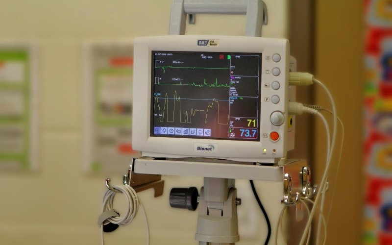 Hospital heart monitor device showing pulse readout on a digital screen