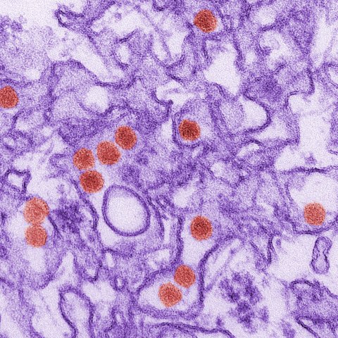 Image depicts a colorized image of Zika virus taken with a transmission electron micrograph. The virus is depicted as red circular shapes and the rest of the image is purple. 