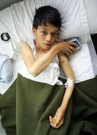 Image of a youth in a Kabul hospital bed from the AP Photo Archive.