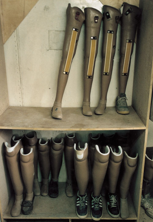 Paul Hansen photograph of prosthetic legs in Kabul, Afghanistan.